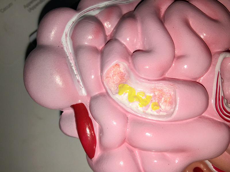 Human Digestive System Model: Large Intestine, Rectum, Duodenum, Stomach & Intestines Anatomical Structure