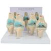 Knee Joint Model with FourStage StandStage Musculoskeletal for Medical Students,