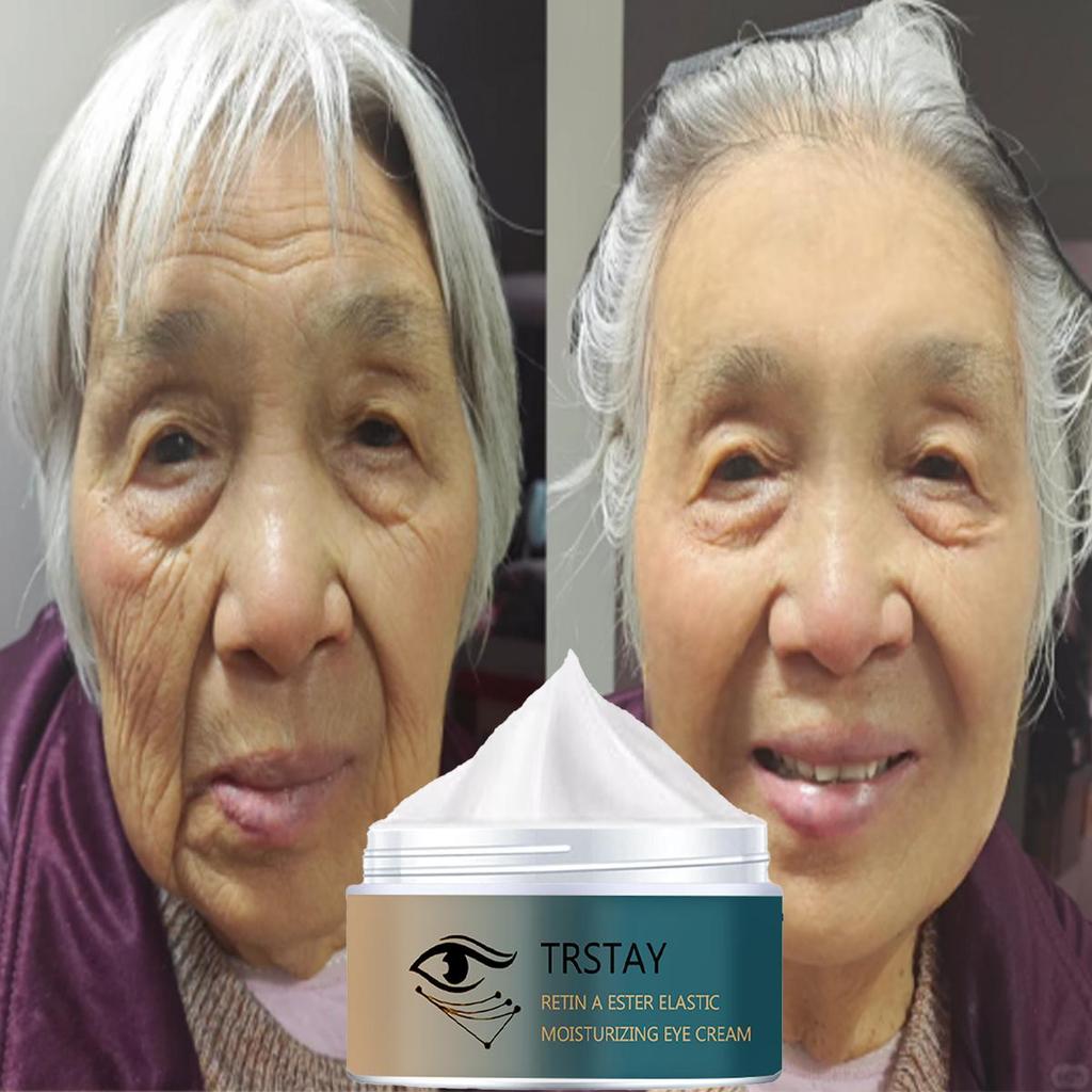 Face Cream Facial and Eye Anti-aging Essence Lifts, Tightens, Lightens Spots, Promotes Collagen and Reduces Fine Lines
