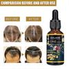 Ginger Germinal Oil Plant Essential Oil Hair Nutrient Solution Hair Growth Essence Liquid