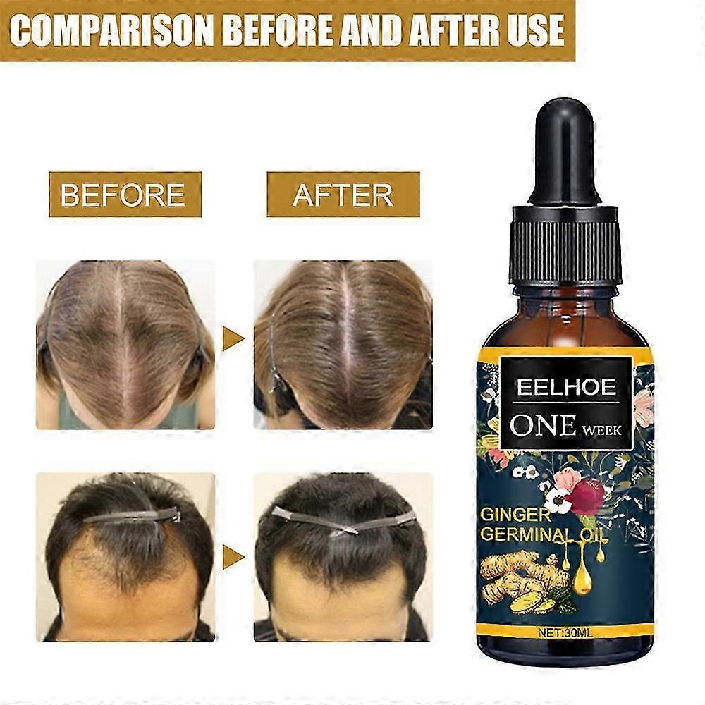 Ginger Germinal Oil Plant Essential Oil Hair Nutrient Solution Hair Growth Essence Liquid