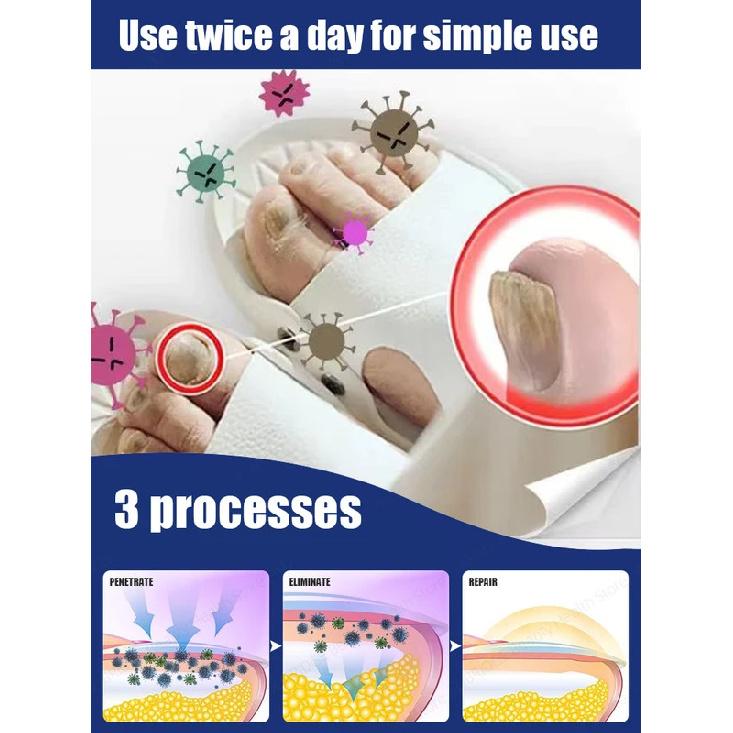 A best-selling product in 2026, quickly restores shine and reduces worries.