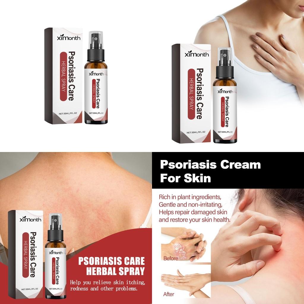 Ximonth Skin Repair Spray Soothing Hydrating Relief For Itchy Red Skin Moisturizer