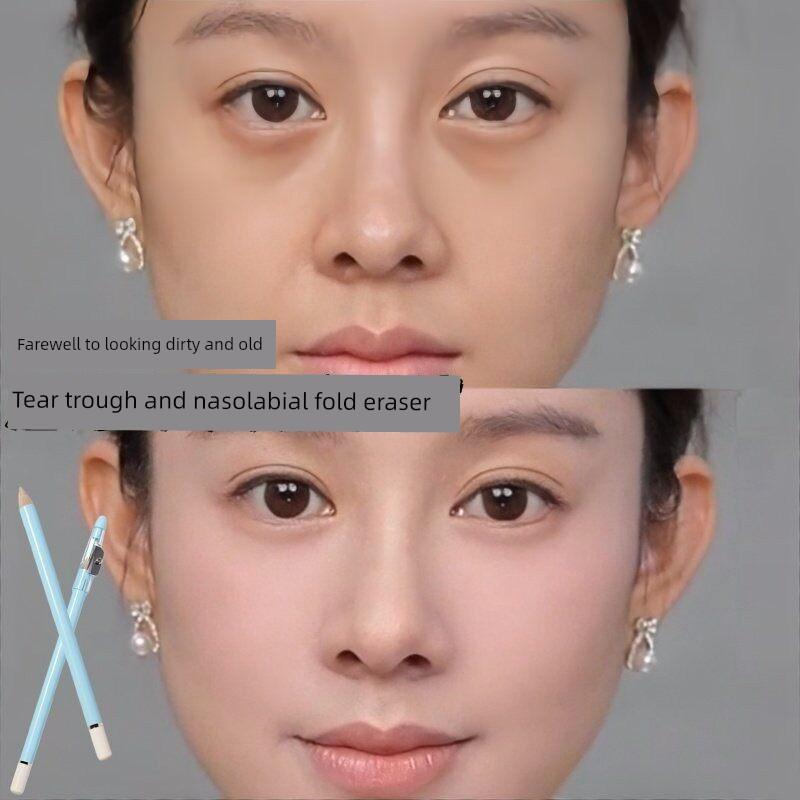 Precision Concealer Pen to Cover Tear Troughs, Nasolabial Folds, Acne Marks, Spots, Wrinkles, Eye Bags, Dark Circles, Delicate and Natural-Looking,