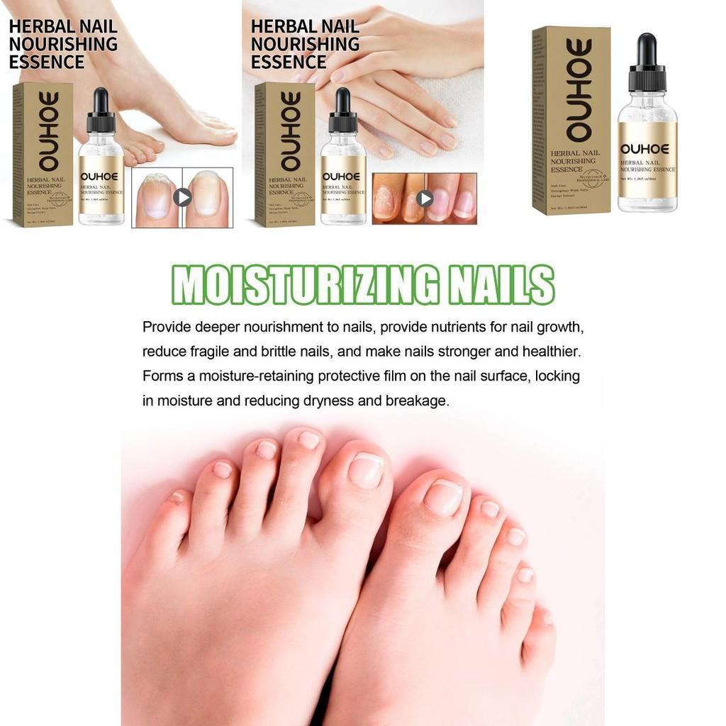 Nourishing Ouhoe Nail Care Essential Oil For Healthy Strong Nails And Cuticle Repair