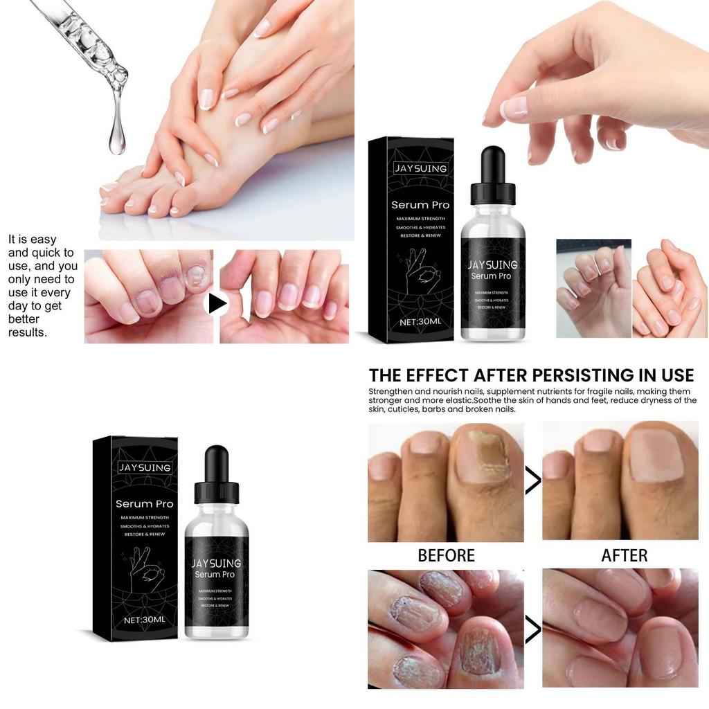 Nourishing Jaysuing Nail Repair Essence For Healthy Strong Nails 30ml