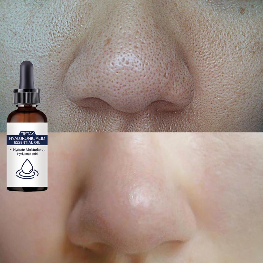 Hypoallergenic Face Cream With Collagen & Hyaluronic Acid – Moisturizing, Firming, Wrinkle-Smoothing & Pore Shrinking - Suitable For All Skin Types