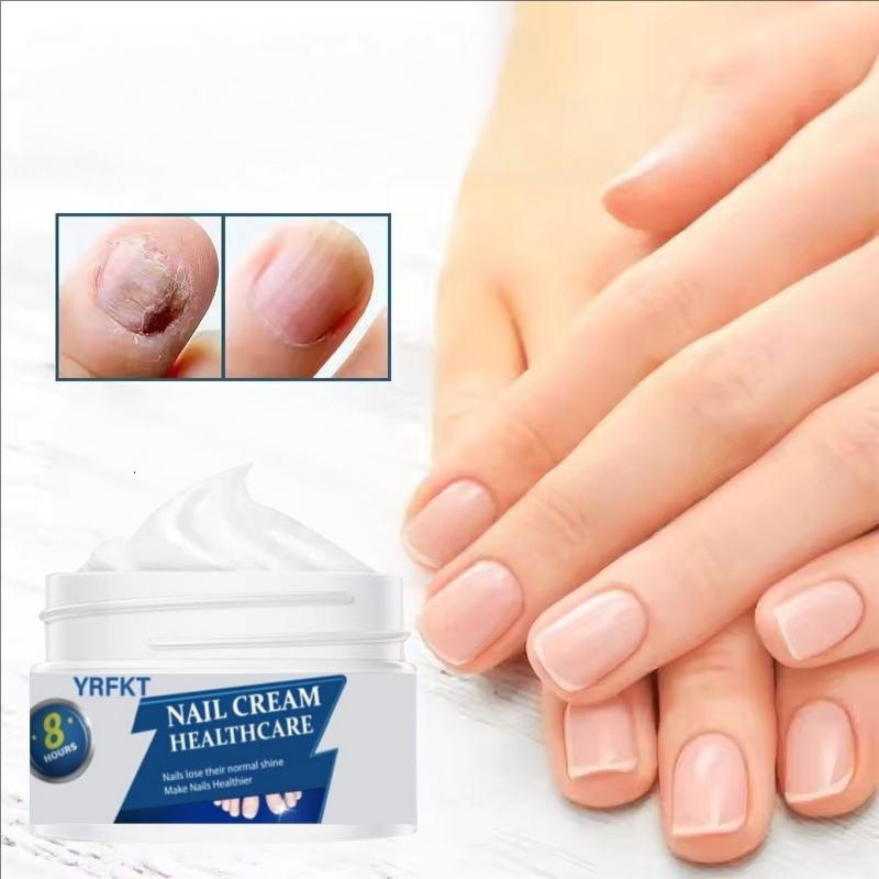 Nail Care Cream, Safe and Gentle for Repairing Nails On Hands, Feet, and Toes, Removing Nail Fungi, Repairing and Caring for Paronychia