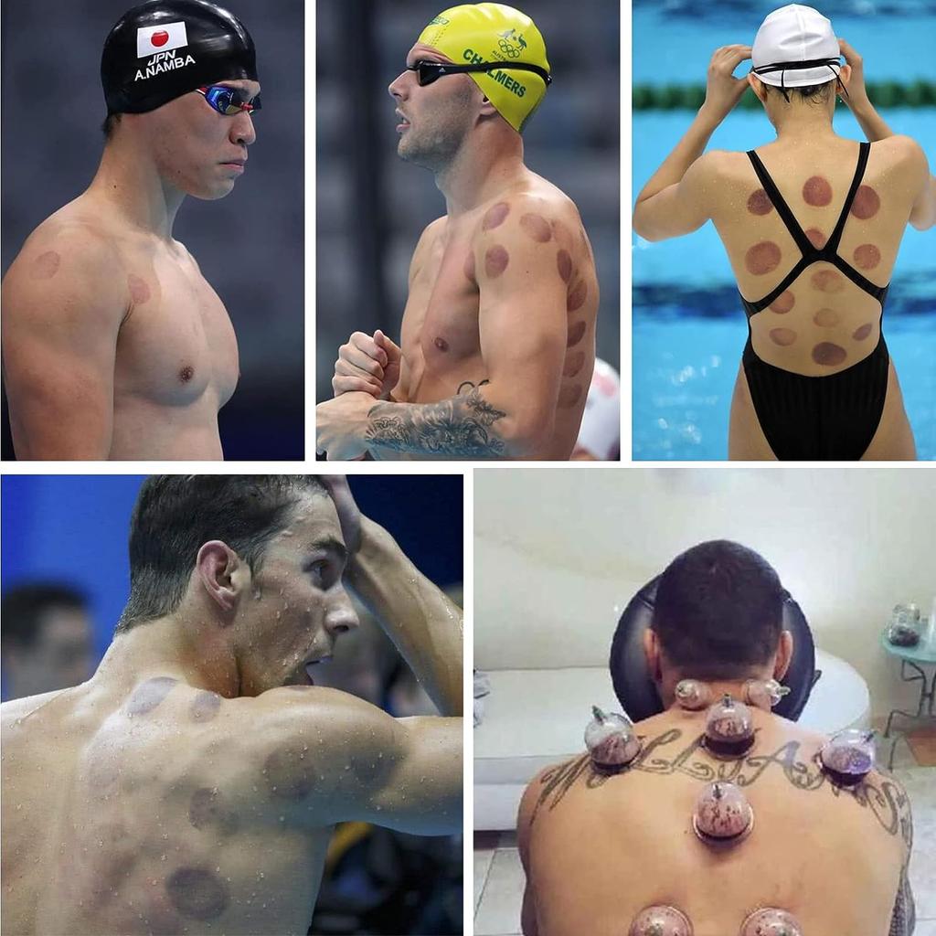 Koppesett, Koppingterapisett, 12/18/24 kopper Profesjonelt kinesisk koppesett for massasje rygg, smertelindring, fysioterapi, massasjeterapisett