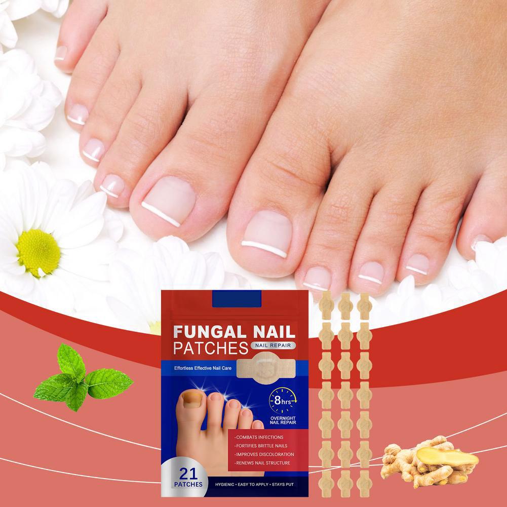 Toenail Fungus Patch Waterproof Nail Repair Patches Nail Ingrown Correction Sticker Nail Ingrown Correction Stickers