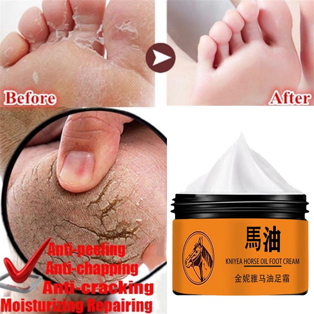 Foot Cream Heel Crack Repair Cream Dead Skin Removing Hand and Foot Care Moisturizing Cream