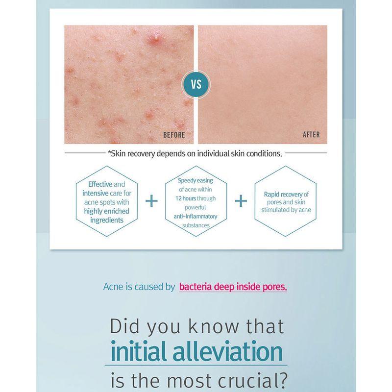 Pyunkang Yul - Acne Spot Cream 15ml