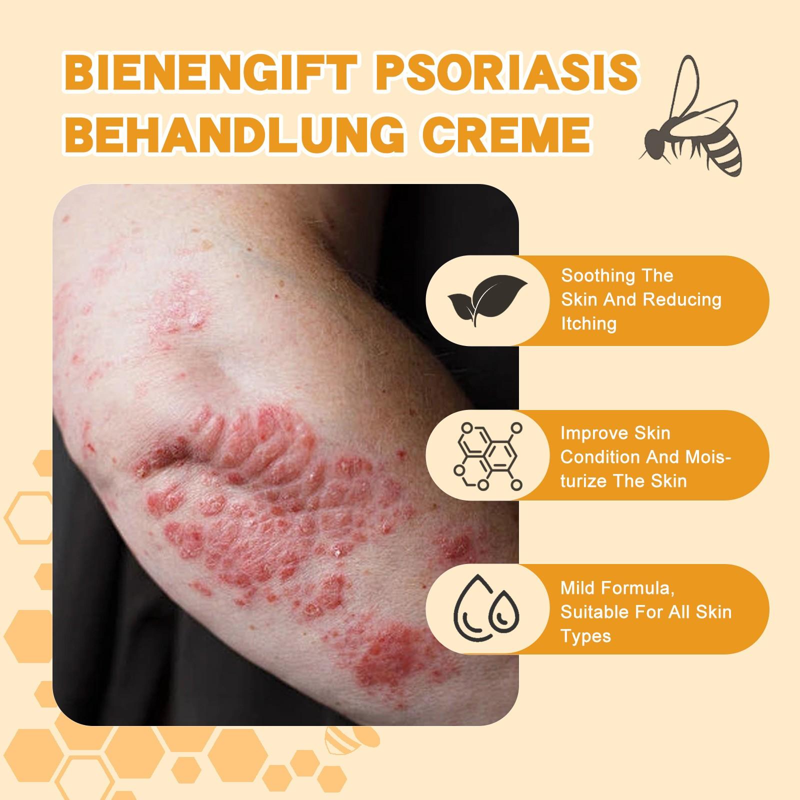 Уход за пчелиным коровьим мхом снимает зуд — фото 5