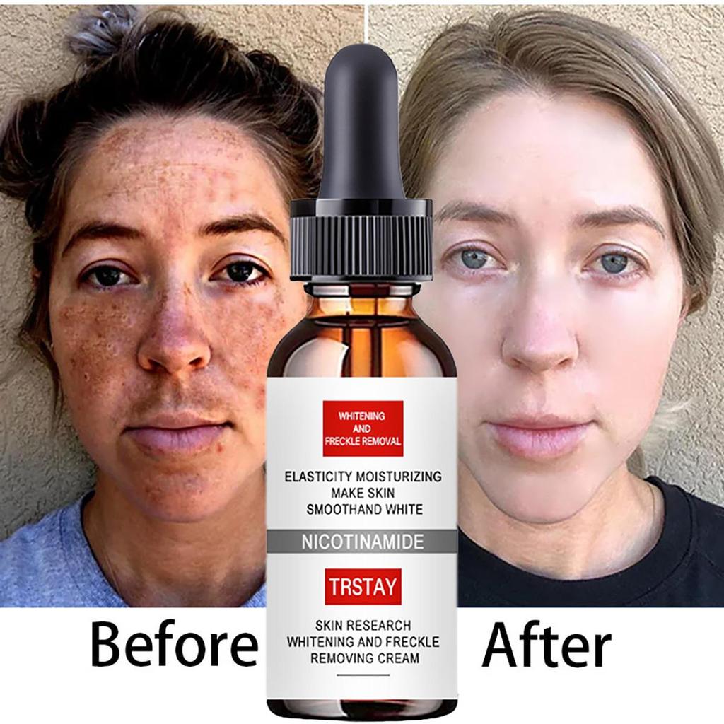 Lighten Spots And Moisturize Face Cream To Brighten Skin Tone And Fight Off