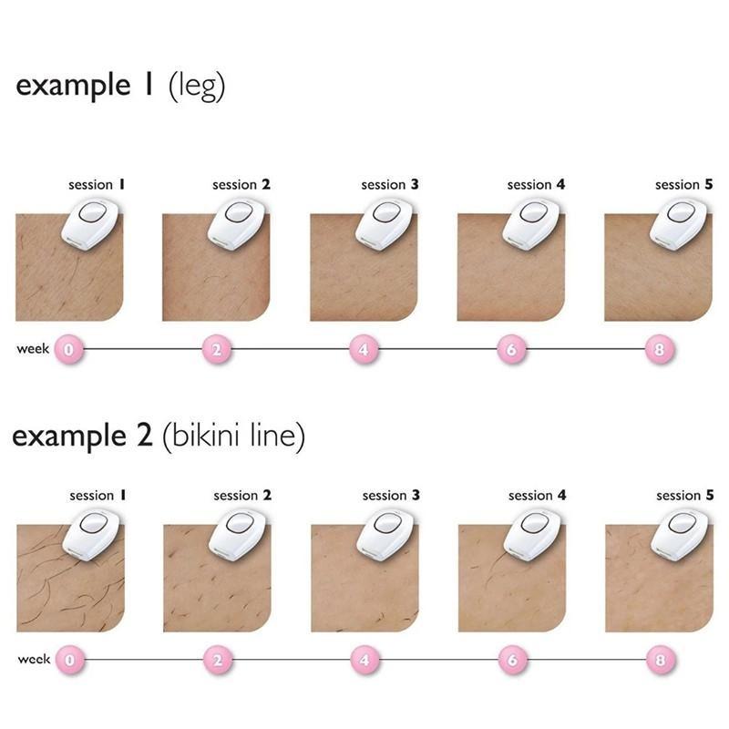 IPL Epilator Laser Hair Removal Device & Rejuvenation Shaving for Men & Women Handheld Home Use Hair Remover Painless Intense Pulsed Light