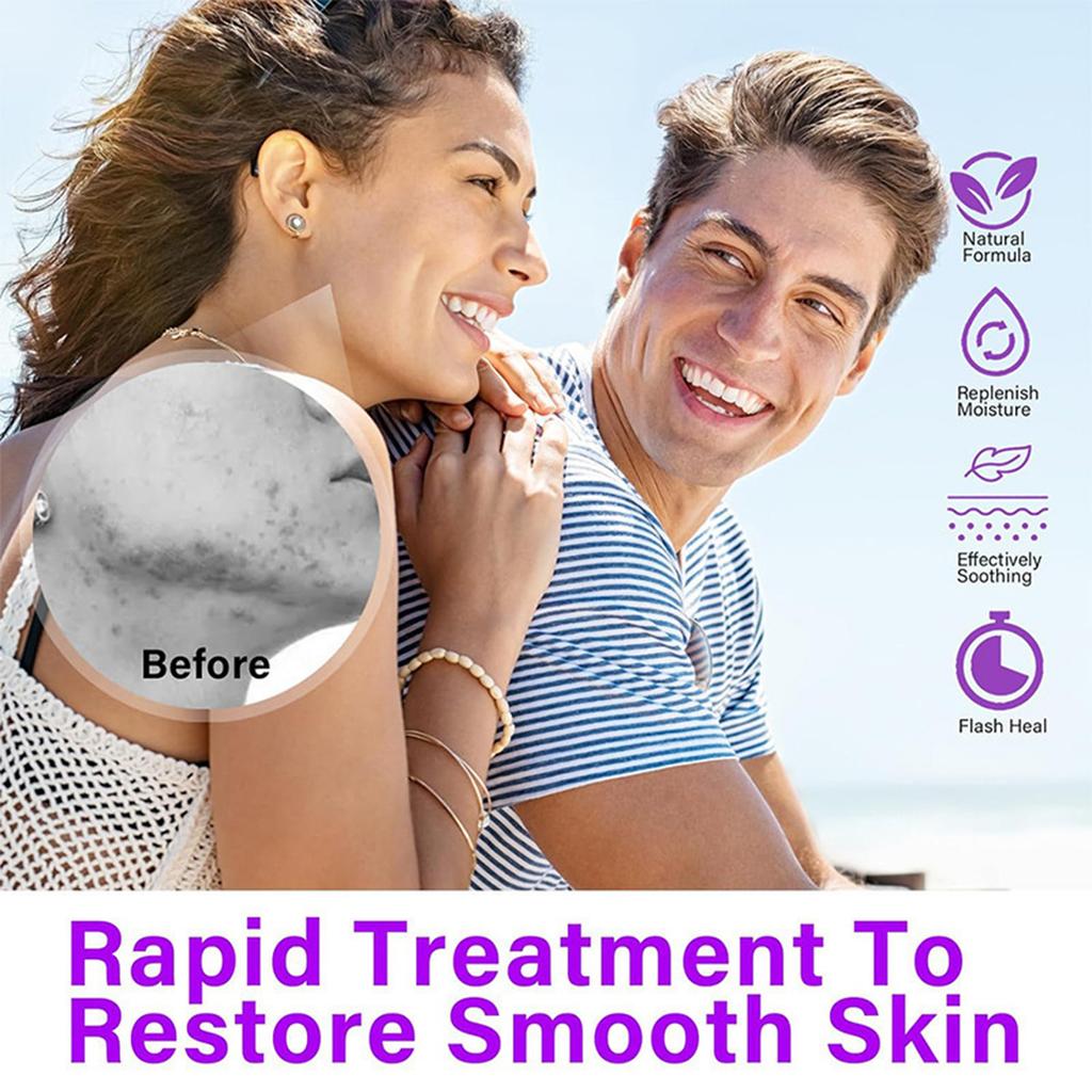 12% Azelainsäure Gesichtsserum Haut Hyaluron Und Beruhigend Und Aufhellend Den Hautton 20G