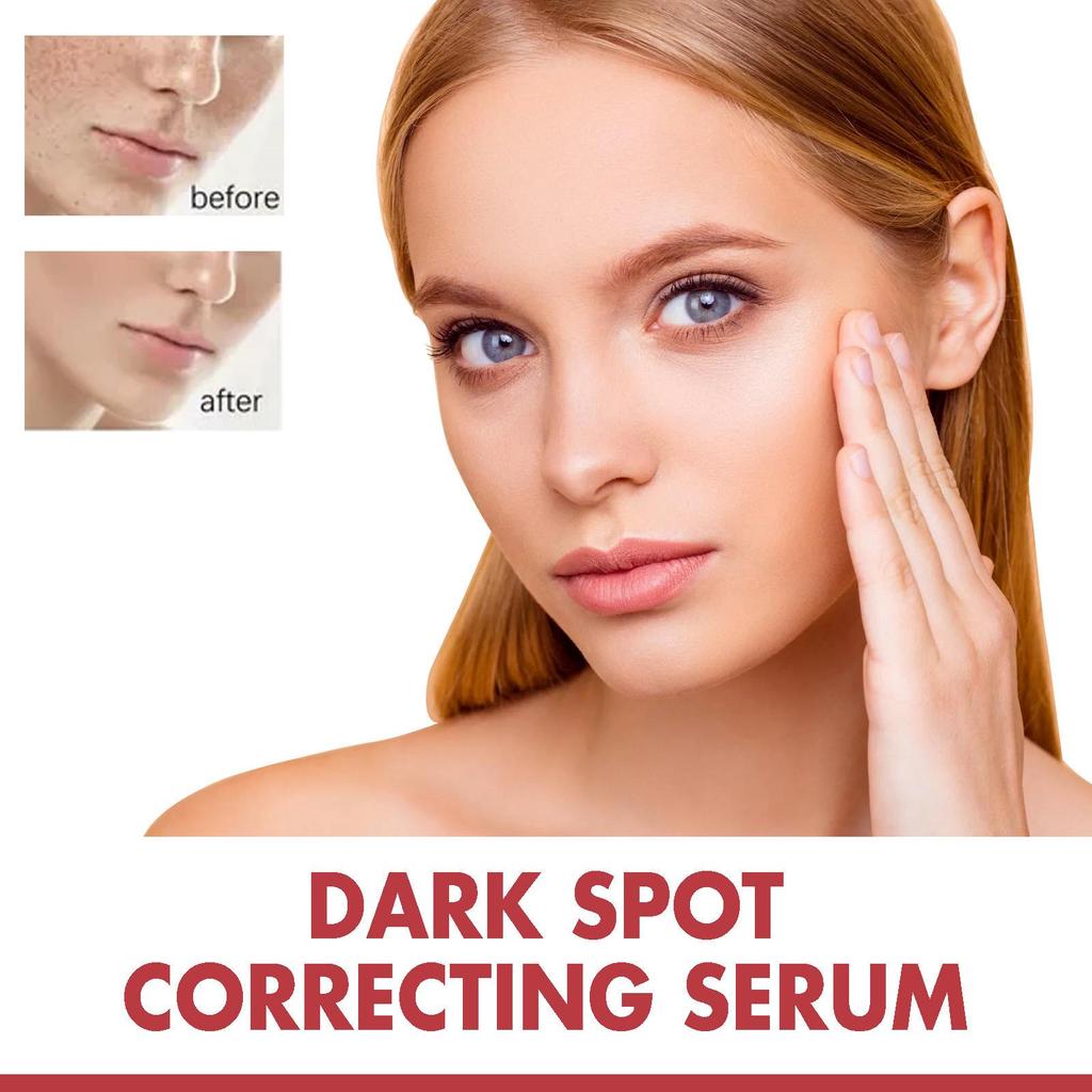 Hoygi Dark Spot Repair Essence: Lightens Dark Spots, Reduces Pigmentation, Age Spots, Moisturizes and Brightens Skin.