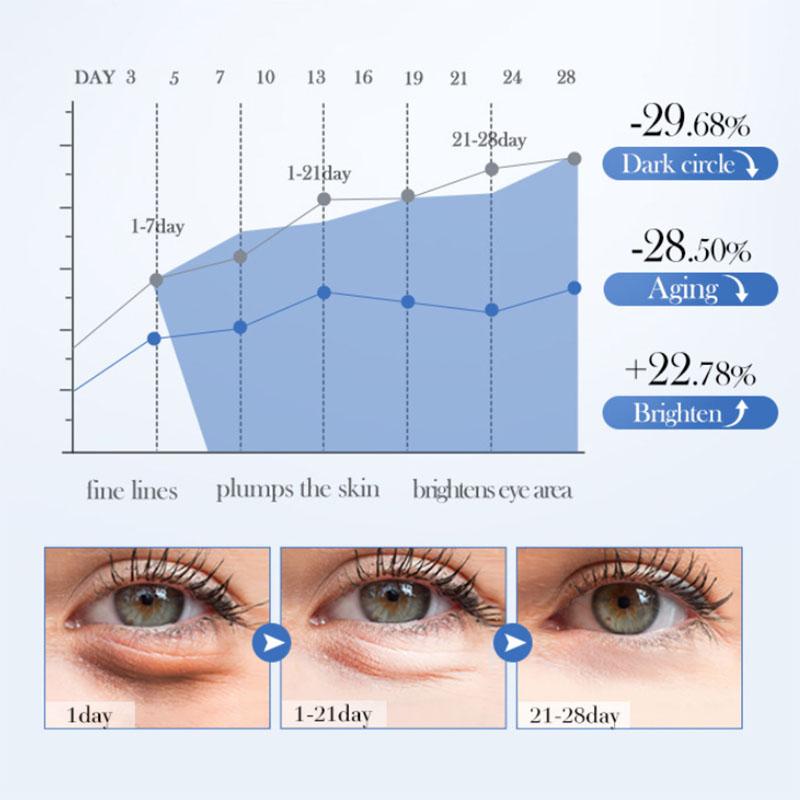 SADOER Caviar Hyaluronic Acid Eye Cream Anti Dark Circles Removal Eyes Bags Firming Moisturizing Beauty Eyes Skin Care Products