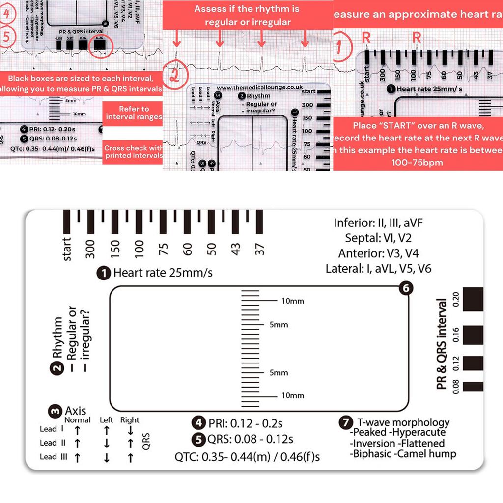 Professional ECG 7 Step Ruler Card Portable Pocket ECG Interpretation Guide Card For Accurate ECG/EKG Interpretation