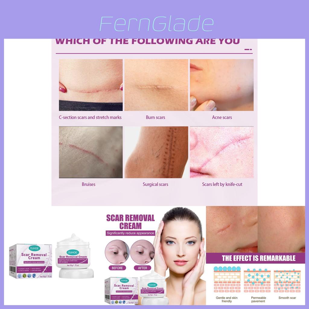 Ouhoe Scar Care Cream For Smoothing And Moisturizing Skin With Gentle Formula
