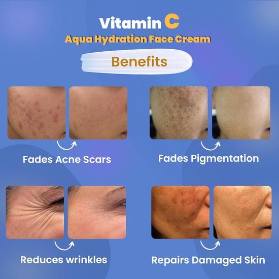 WildOak 5% Vitamin C | Reduces Acne Scars, Hyperpigmentation & Dullness | Repairs & Hydrates Skin | Lightweight, Non-Greasy Formula | 100ml