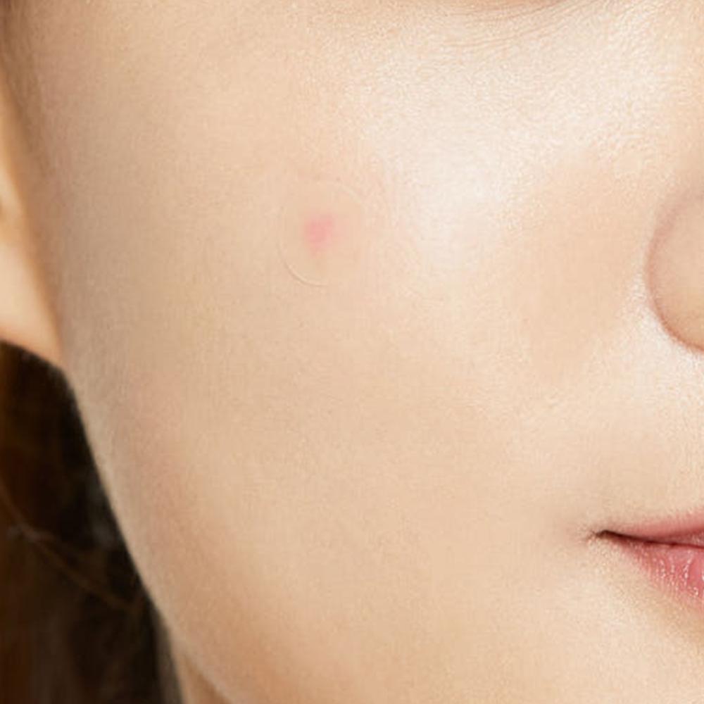 COSRX Acne Pimple Master Patch 24 patches (5 packs)