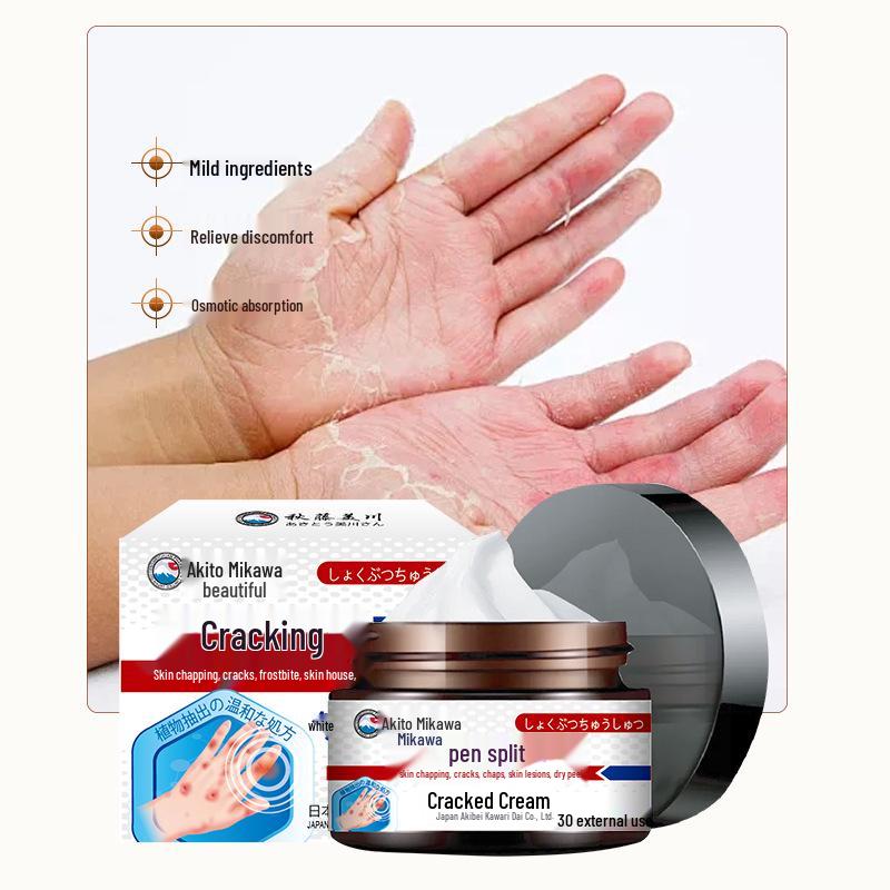 Cremă calmantă Qiuteng Meichuan pentru piele crăpată - Ameliorează crăpăturile și descuamarea