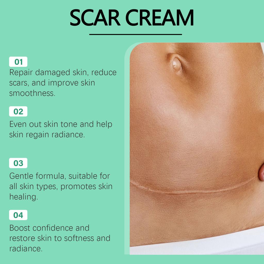 Moisturizing Rejuvenating Wiyun Body Cream Offering Superior Skin Hydration And Care 50g