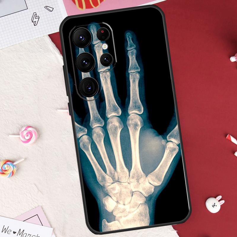 Skeleton Art Case For Samsung Galaxy S26 Ultra S23 S22 S21 S20 S24 S25 Ultra S10 Plus S25 FE Cover Shell
