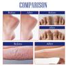 South Moon Hand And Foot Repair Cream Smoothes Rough Cracked Skin Hydrating Moisturizing