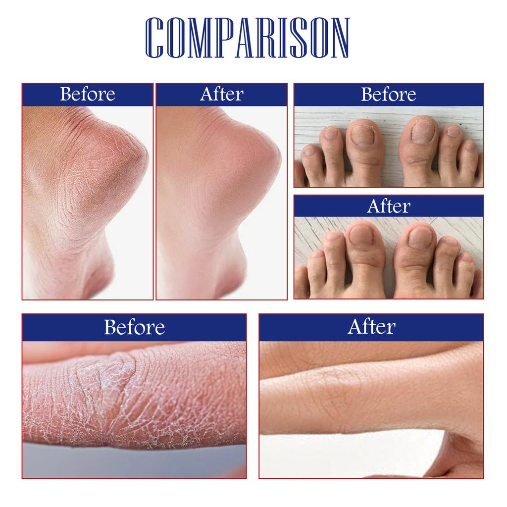 South Moon Hand And Foot Repair Cream Smoothes Rough Cracked Skin Hydrating Moisturizing