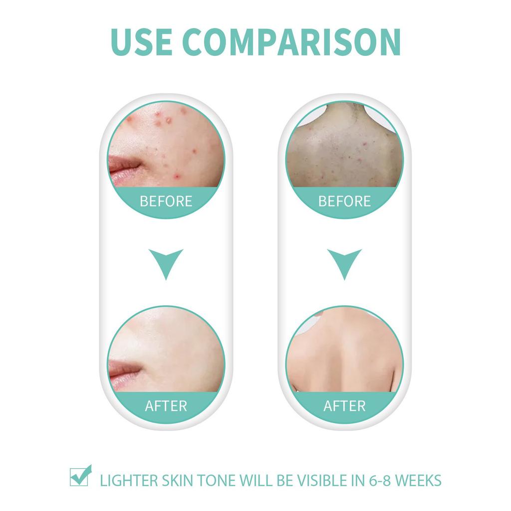 Ingrown Hair Care Ball Bump Care For Bikini Area Jade Care,Specially Designed For Delicate Areas,Offering Targeted Relief From Shaving Bumps 100ML