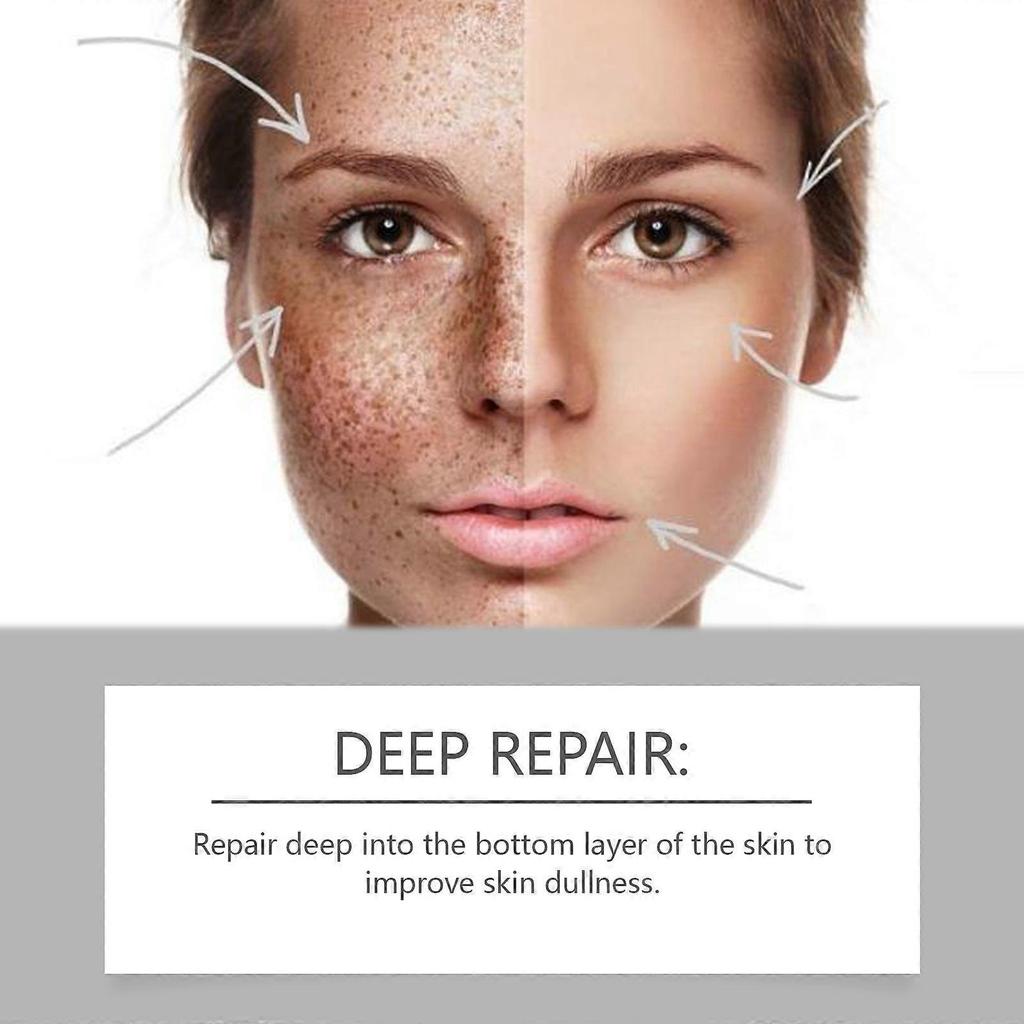 Moisturizing and moisturizing lotion, firming and anti-wrinkle cream, effective in reducing dark spots with Arbutin and hyaluronic acid