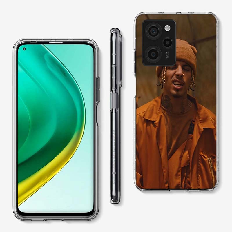 R-Rauw Alejandro Rapper Cover Telefonfodral För Xiaomi Poco M8 M7 M6 M4 M3 X7 X6 X4 Pro F7 Ultra M5S Mi 14 14T 15 15T 12T 10T Pro 1