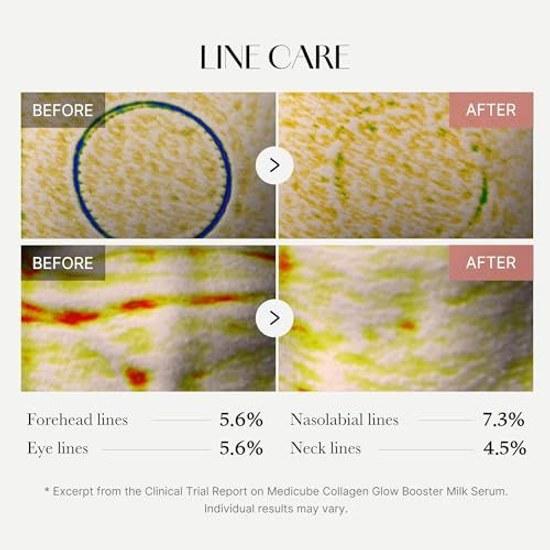 Medikube Collagen Glow Booster Serum Plump High Concentration Wrinkle Peptide Hydrated Skin Dull Extremely Dry Korean Skincare