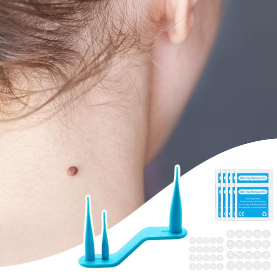 Skin Tag Remover One Hand User Friendly Home Use Safe Effective Skin Tag Removal Device Personal Care Kit