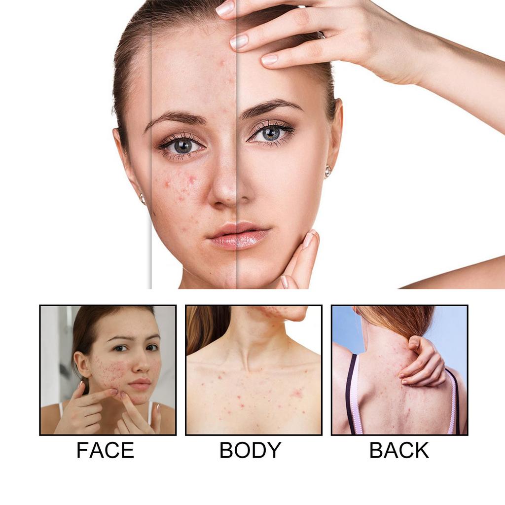 Large Capacity Pimple Patches, Colorful Cute Zit Covers,Hydrocolloid Acne Patches With Tea Oil, Witch Hazel, Centella Asiatica , Hyaluronic Sour