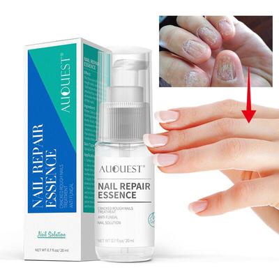 Essence Nail Foot Whitening Toenail Fungus Removal Gel