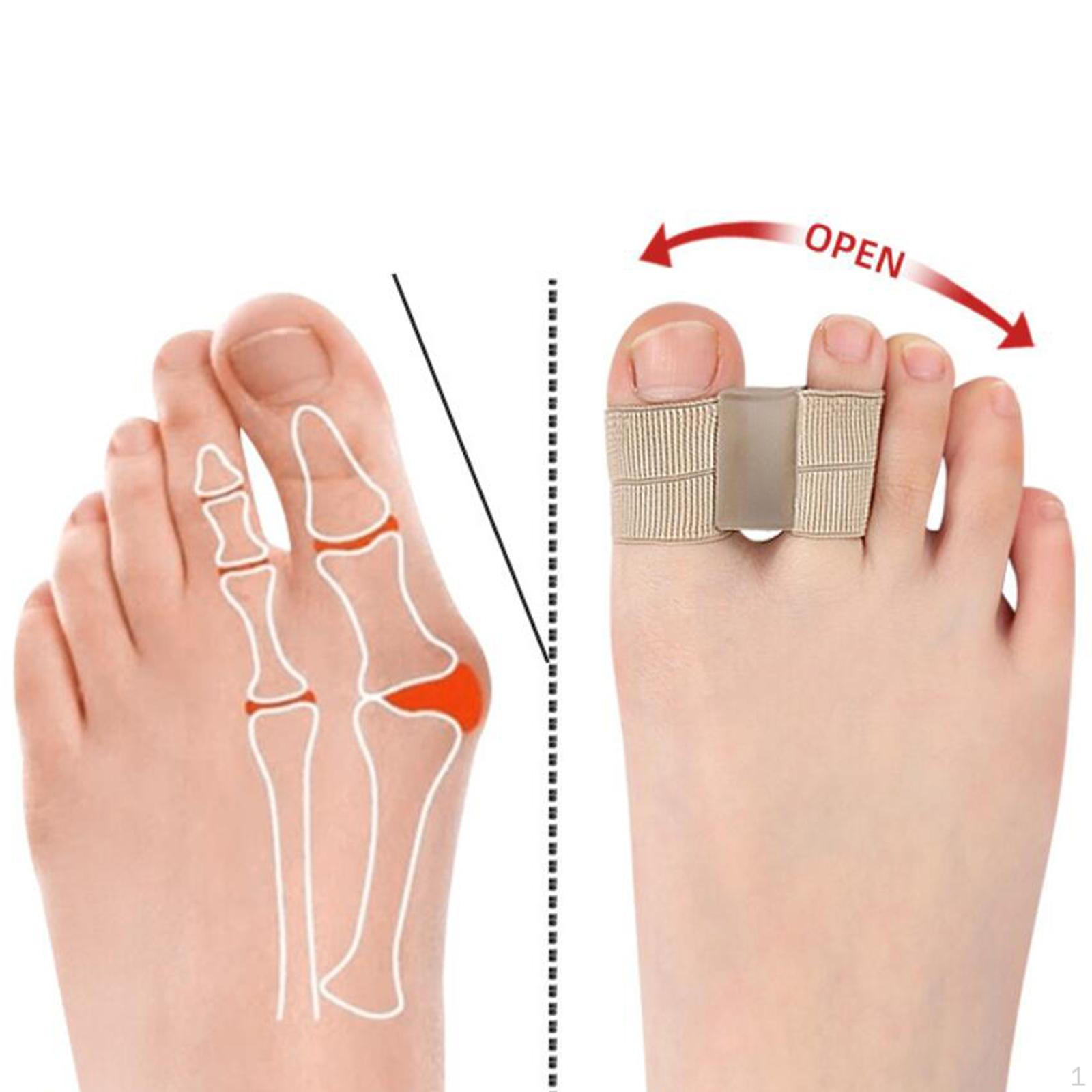 

Корректор-разделитель пальцев ног, большой защитник для мужчин и женщин