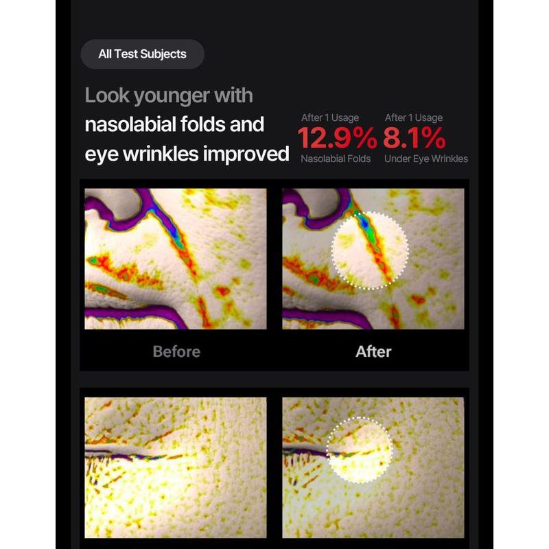 Meditherapy Shumage Gold Seal Lifting Cream & EMS Device Set