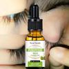 Eyelash Fast Grow Serum Lengthen Thicken Natural Curl Enlargement  Eyelash Growth Natural Eyelashes Growth Serum In A Week