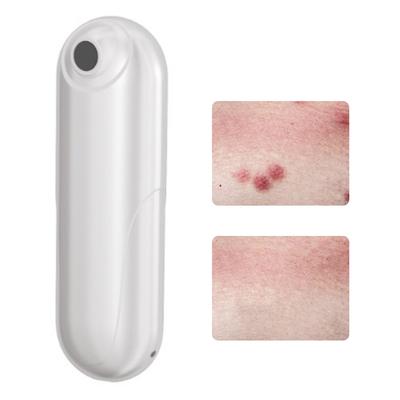 Bug Bite Itch Relief Tool USB Rechargeable Mosquito Bite Sucker Chemical Free for Bug Bites Bee