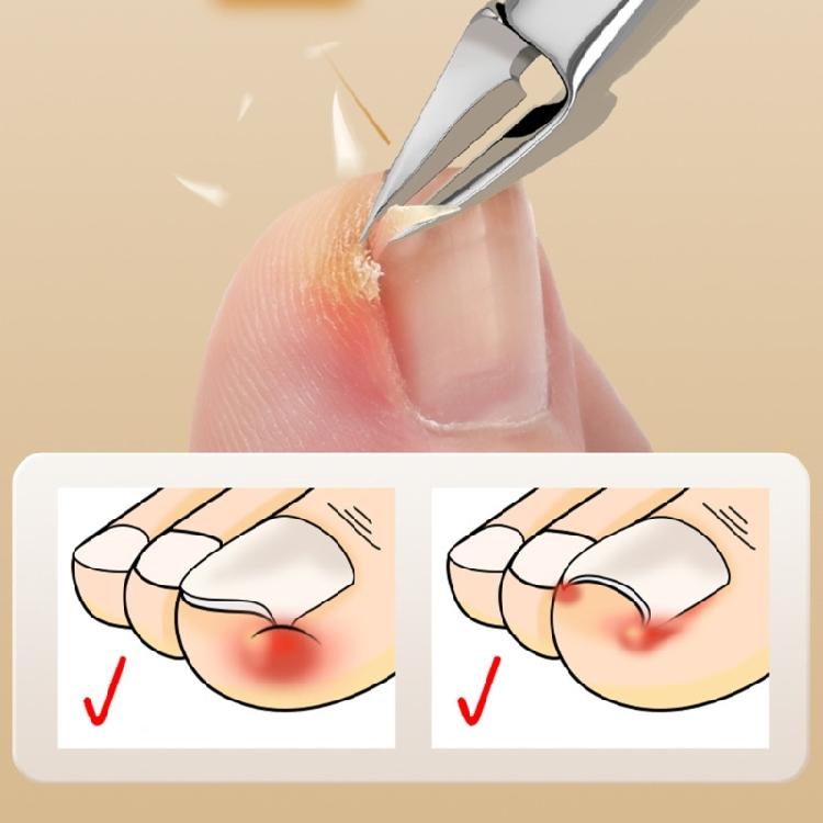 Creative Nail Clippers Tool Set for Thick Nail Professional Correction Tools for Enhanced Nail Care Experience