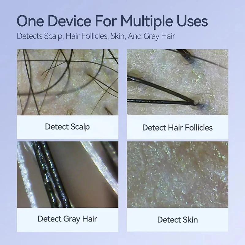 Electron Scalp Detection Pore Magnifier For Face Digital Microscope Camera Dermatoscope Skin Analyzer Machine Head Skin Analysis