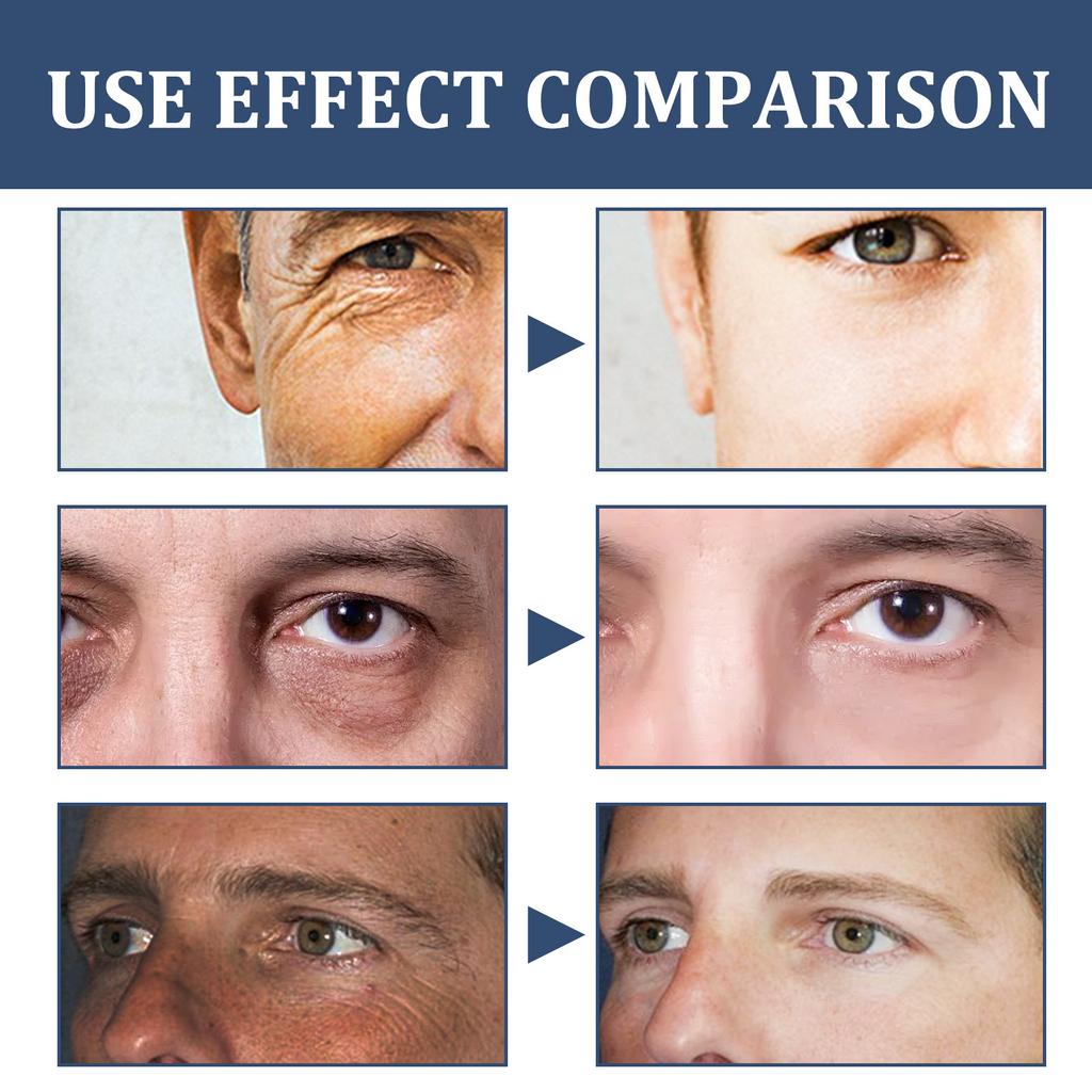 50ml Men's Face Moisturizing Men's Face 6 In 1 Men's Face Moisturizing Men's Face Lotion And Eye Bag Care 50ml