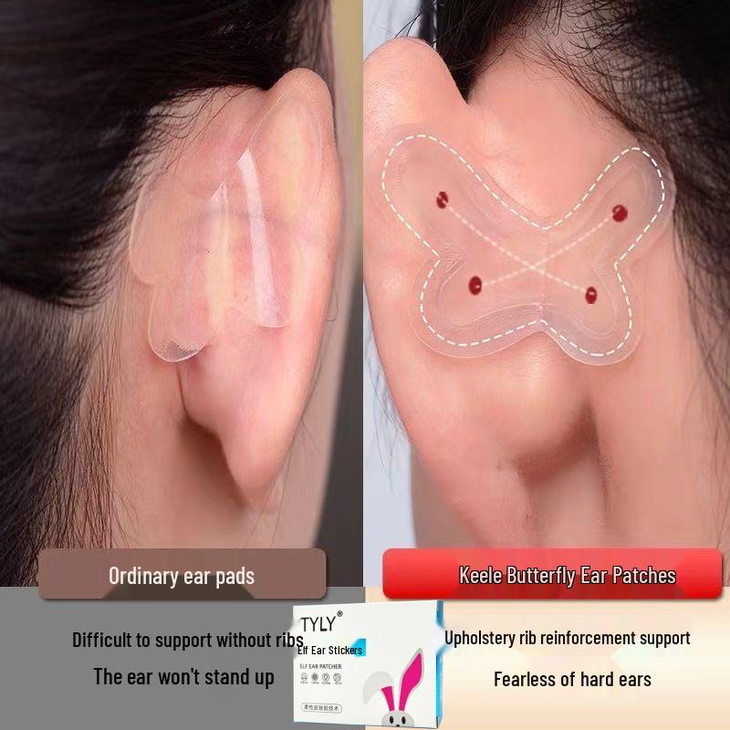 In-Stock Invisible Elf Ear Shaping Stickers for Skin Tone - Painless, Allergy-Free Miracle Device
