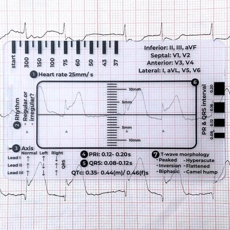 EKG 7stupňové pravítko Přenosné průhledné 7stupňové pravítko Měřicí nástroj Plastové pravítko Měřicí nástroj pro interpretaci EKG