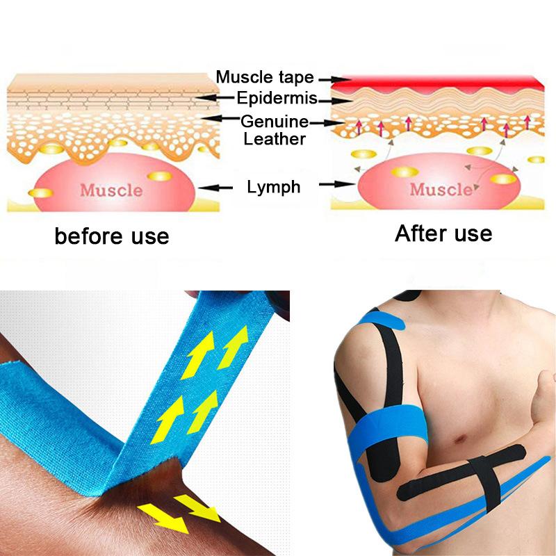 Tape Athletic Tape Recovery Tape Running Knee Muscle Protector Sciss
