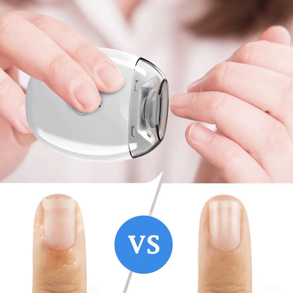 Smart Nail Clippers, Electric Nail Clippers For The Elderly, Electric Nail Clippers, Fully Automatic Nail Clippers