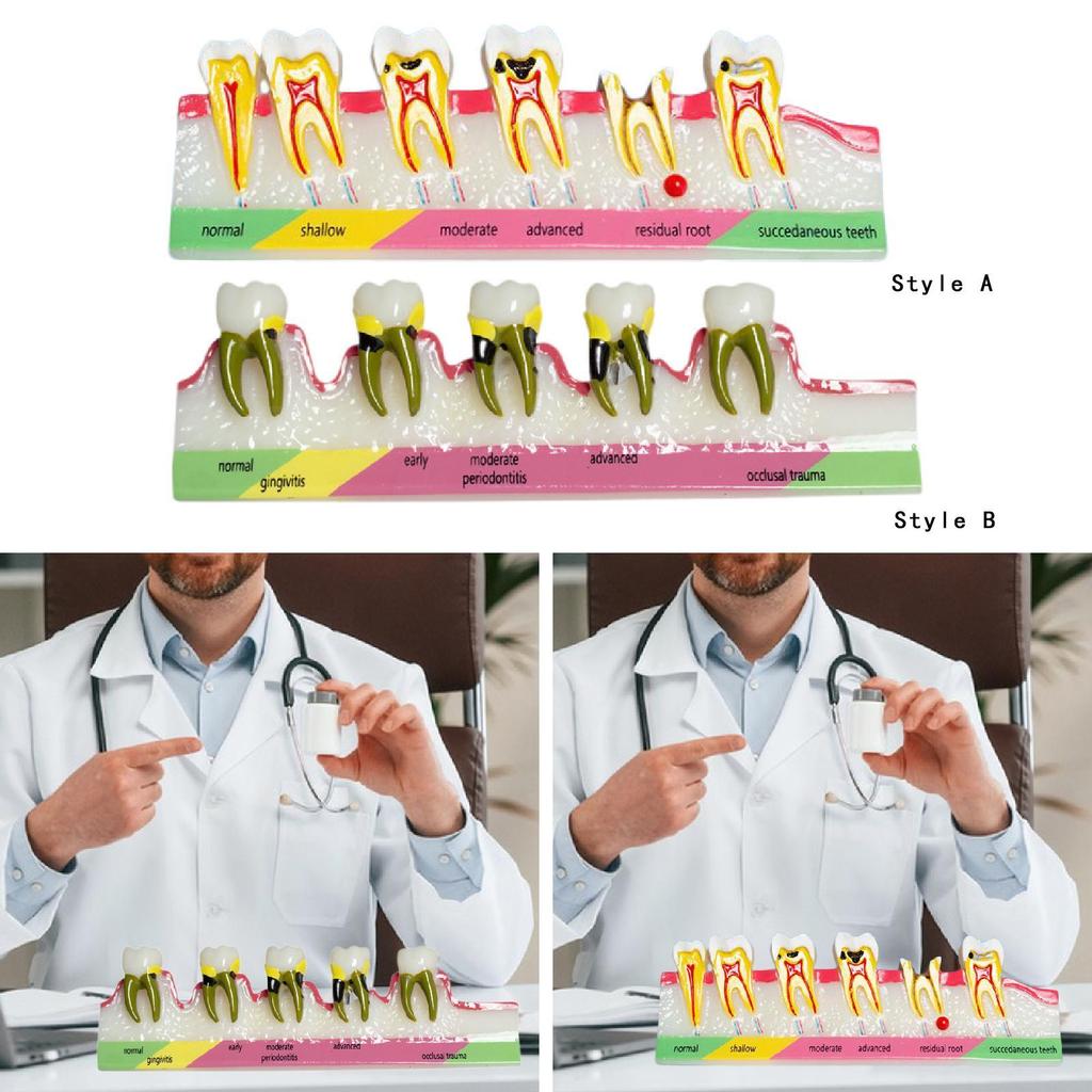 Demonstration Tooth Model Soft Education Clean Display Removable Dental Model Dental Teaching Teaching Tool Standard Tooth